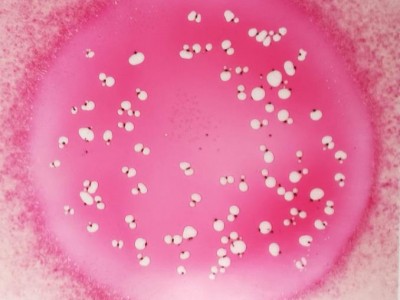 大肠菌群检测：食品大肠菌群检测标准（国标）