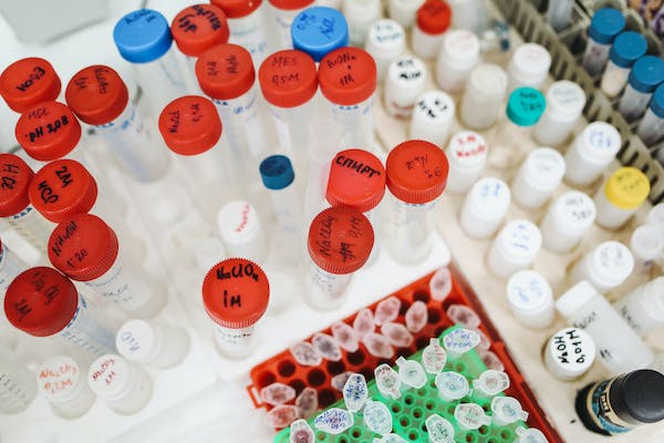 微生物抗菌检测,微生物抗菌检测的目的 微生物抗菌检测,微生物抗菌检测的目的